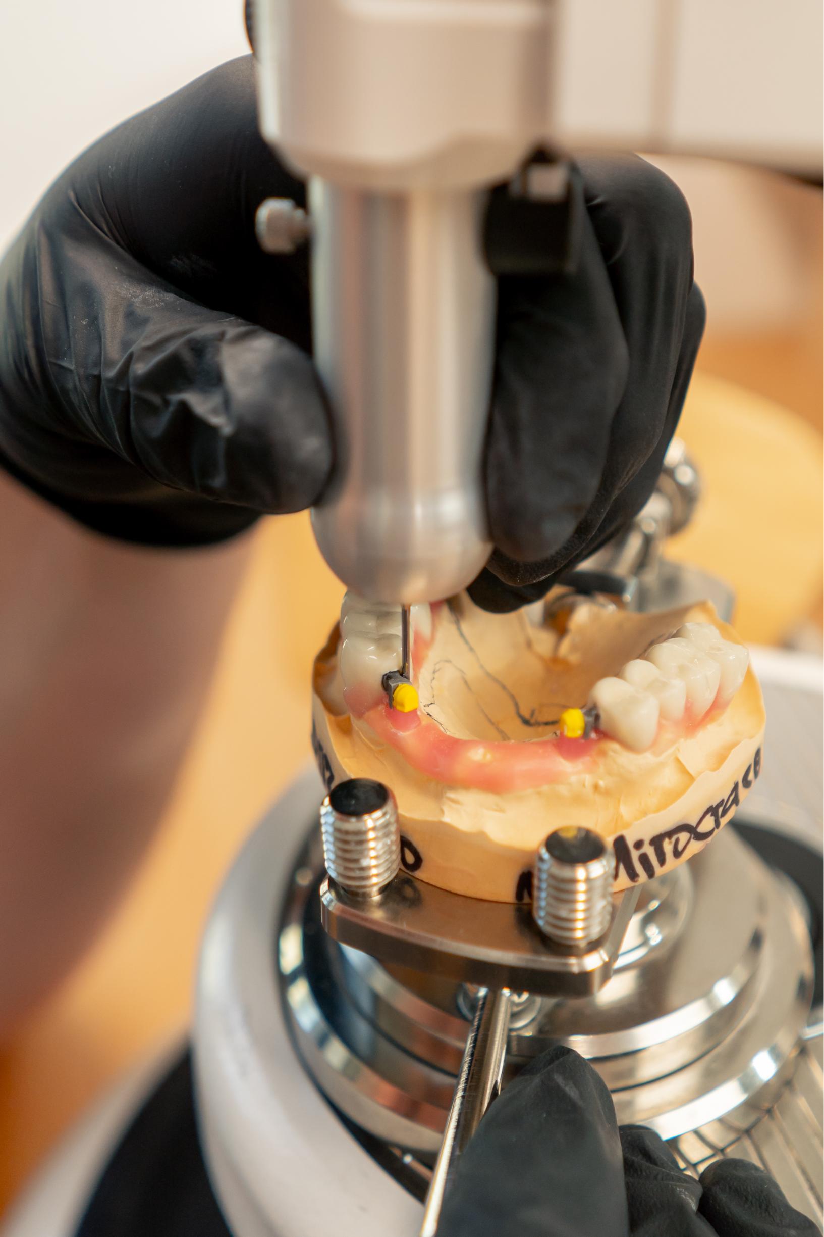 Smiling Patient with New Dentures